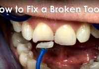 How to Repair a Cracked Tooth at Home: A Step-by-Step Guide